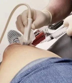 Pain Management Chandler AZ Ultrasound Guided Injection