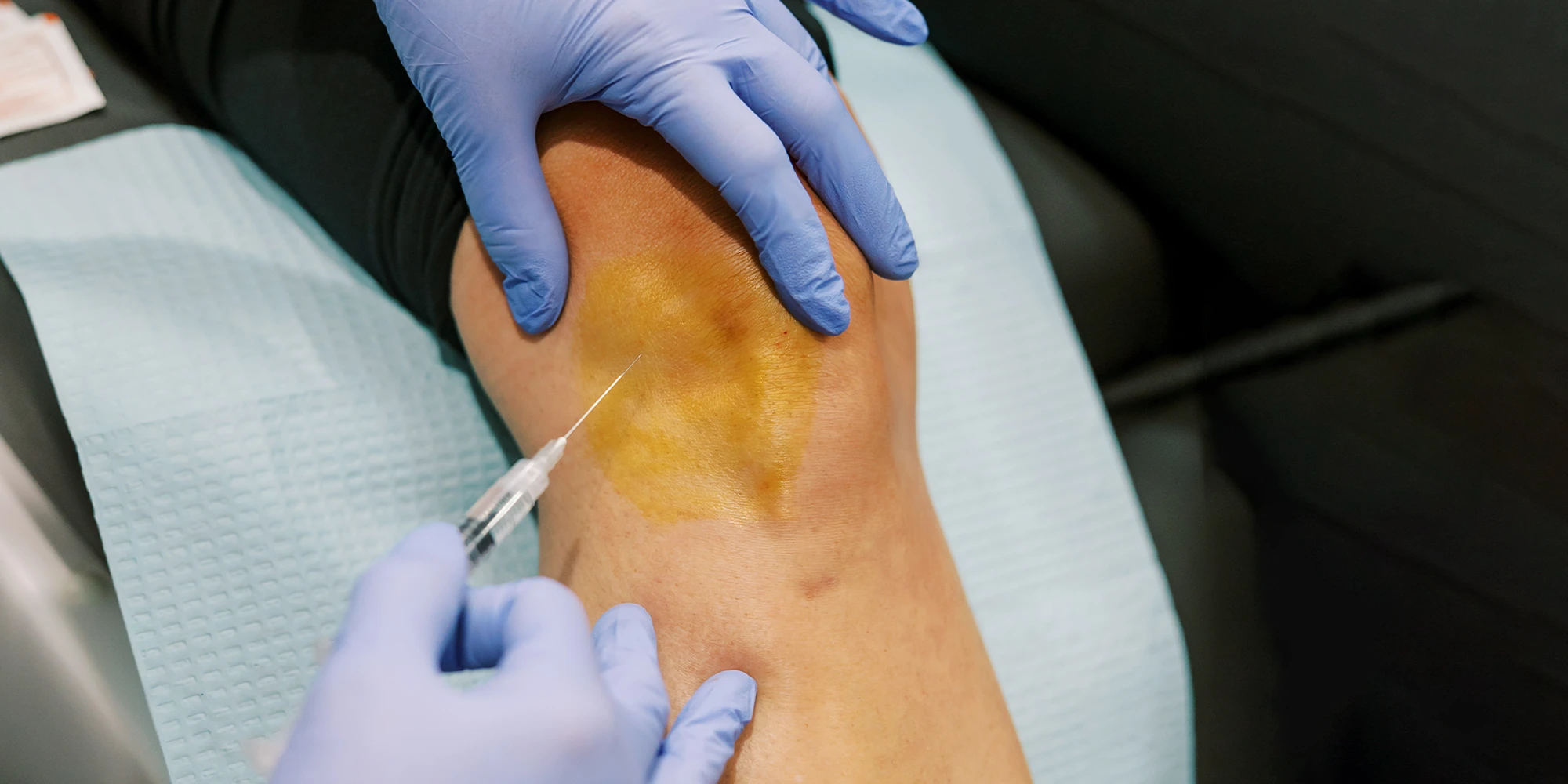 Pain Management Chandler AZ Regenerative Knee Injection